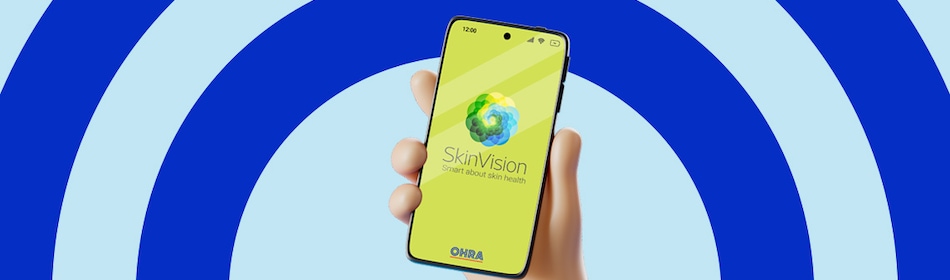 Hand omhoog met Skinvision app op telefoon